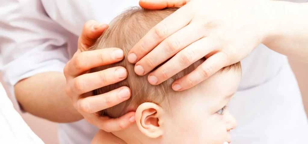 Cabinet Pasapas et Craniopole expertise déformation tête plate chez l'enfant kinésitherapeute ostéopathe Baillargues