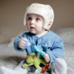 Plagiocephalie craniopole syndrome tete plate bébé port du casque petite enfance baillargues