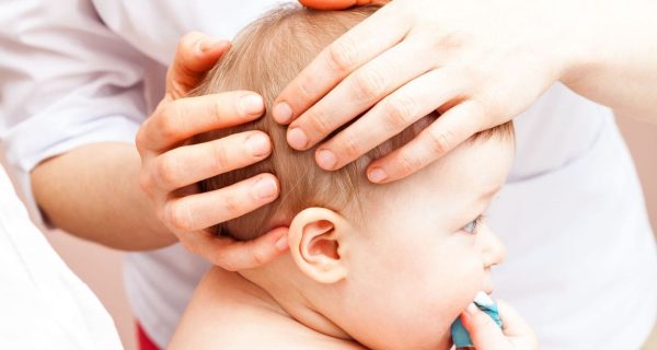 plagiocephalie craniopole tête plate bébé kinesithérapeute ostéopathe petite enfance baillargues